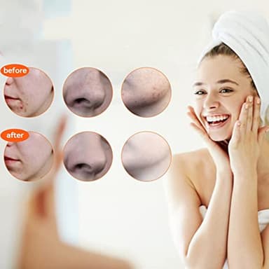 5 kpl huokosmadonpoistoaineita Hopea