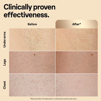 Braun IPL Silk-Expert Pro 5 valoimpulssilaite PL5356
