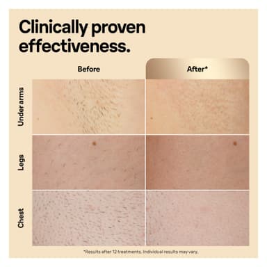 Braun Silk-expert Pro 5 valoimpulssilaite PL5242