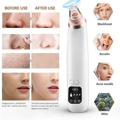 Mr. Blackhead Suction