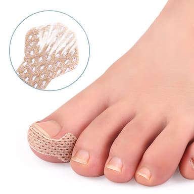 Nauha sisäänkasvaneiden varpaankynsien hoitoon Beige