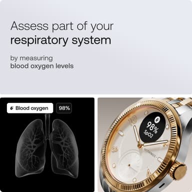 Withings ScanWatch Nova Brilliant hybridiälykello 39 mm (kulta)